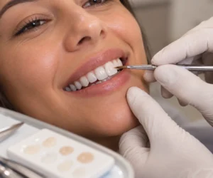 Dentista aplicando faceta de resina em dente anterior em clínica de Ipanema